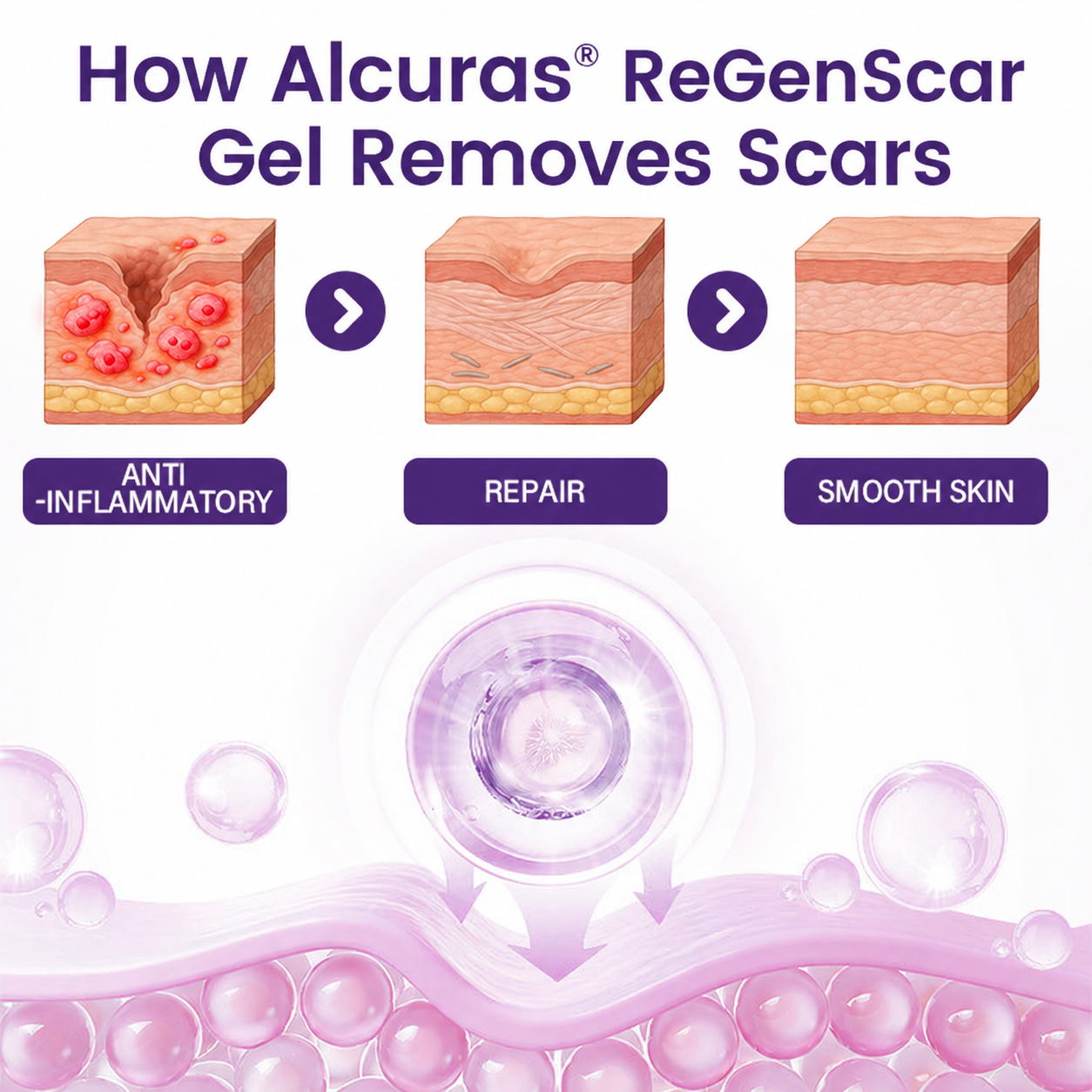 Alcuras® ReGenScar Stem Cell Scar Gel