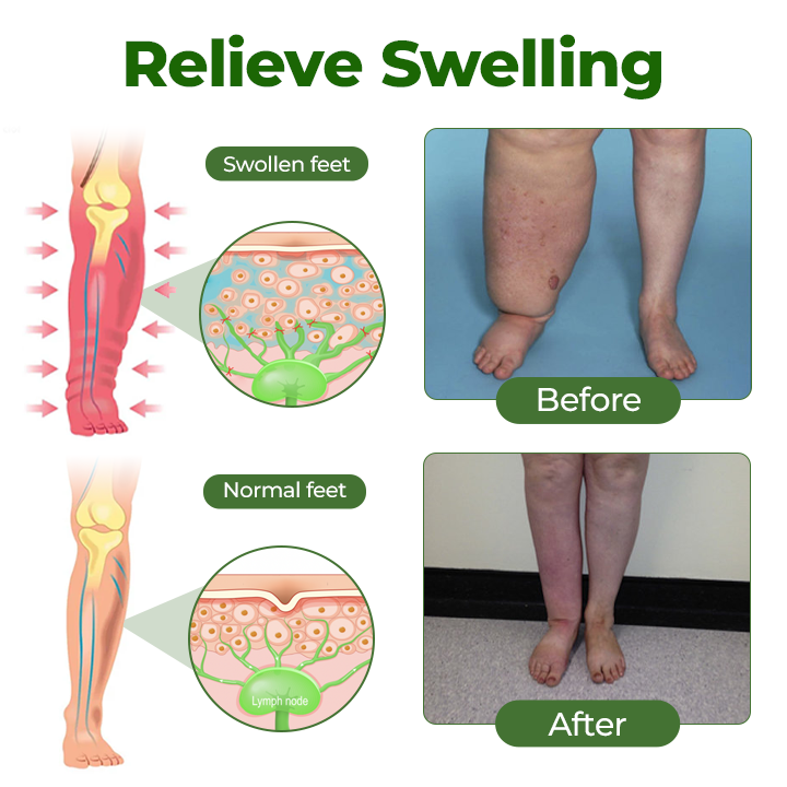 Alcuras® Professional Leg Circulation Cream