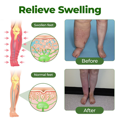 Alcuras® Professional Leg Circulation Cream
