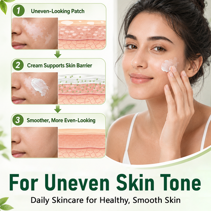 Alcuras® Herbal Vitiligo Cream