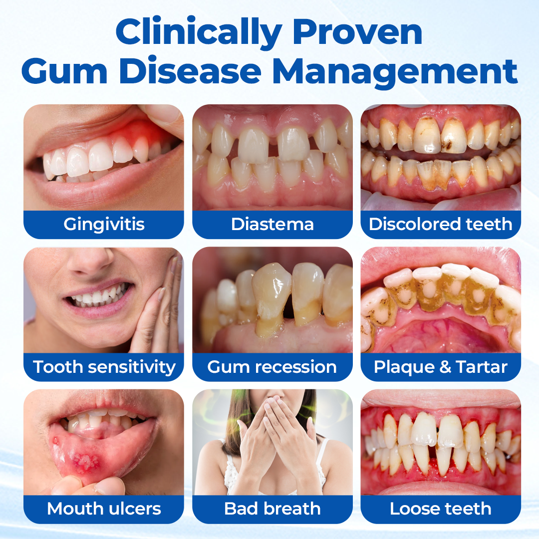 Alcuras® GumBiome Recovery Gel