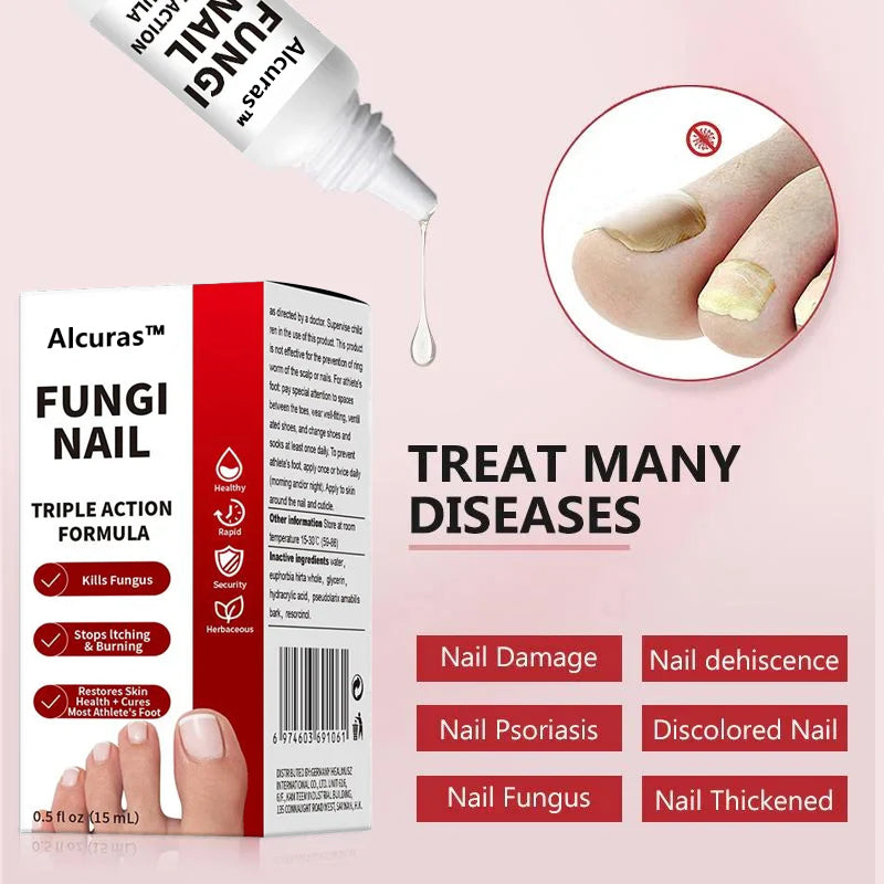Toenail Fungus Treatment Extra Strength Solution