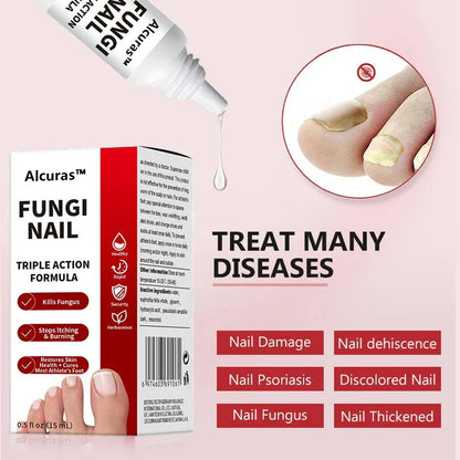 Toenail Fungus Treatment Extra Strength Solution