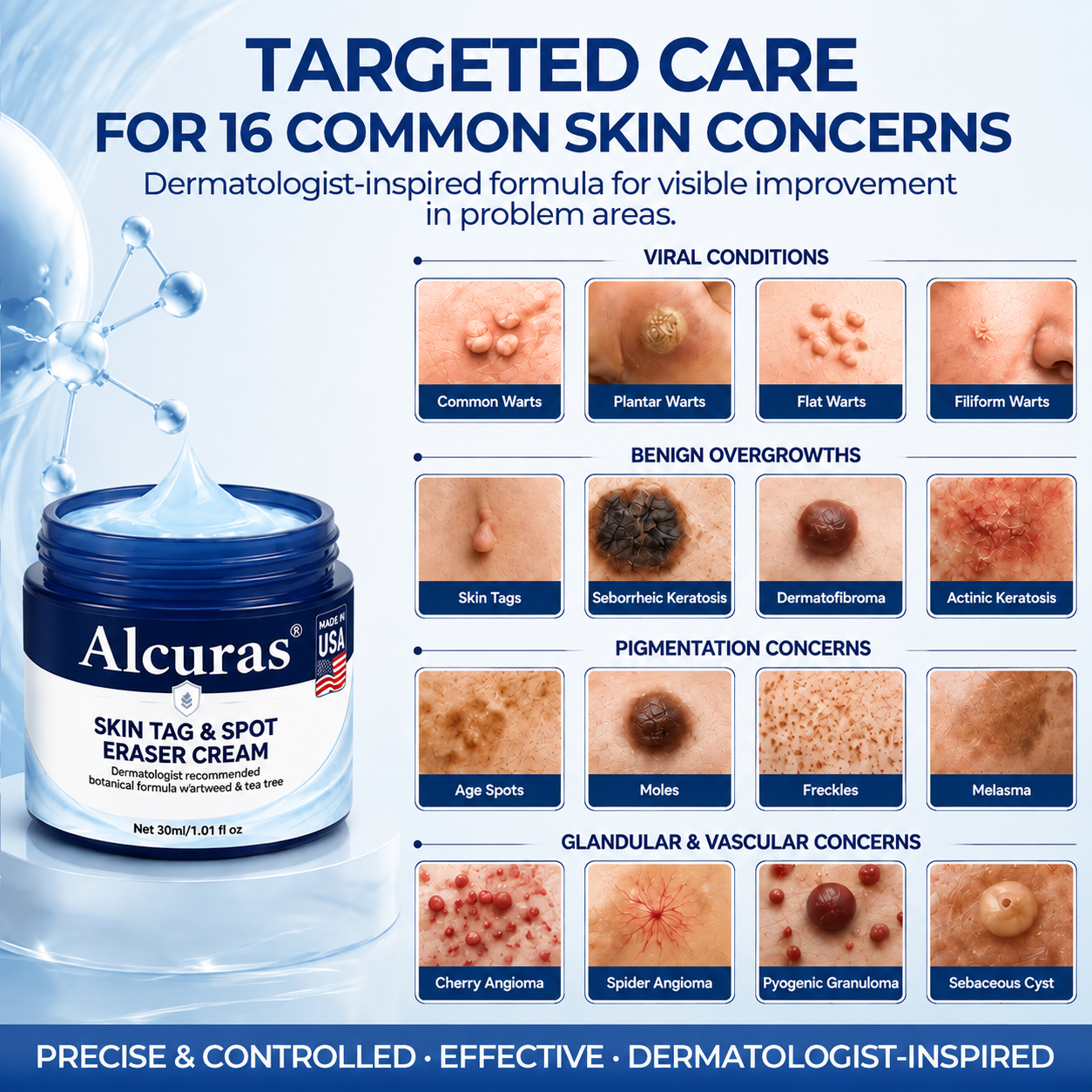 Alcuras® 7-Day Skin Tag & Spot Eraser Cream