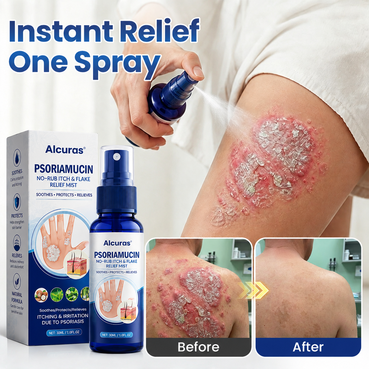 Alcuras®  PsoriaMucin No-Rub Itch & Flake Relief Mist