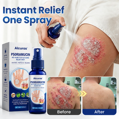 Alcuras®  PsoriaMucin No-Rub Itch & Flake Relief Mist