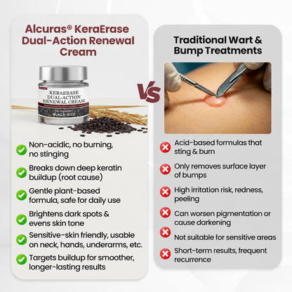 Alcuras® KeraErase Dual-Action Renewal Cream