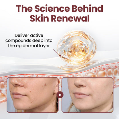Alcuras® KeraErase Dual-Action Renewal Cream