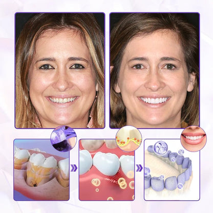 Alcuras® Advanced Gum Healing Toothpaste
