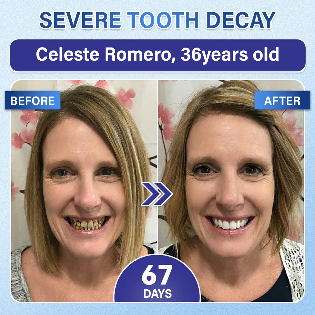 Alcuras®  Tooth & Gum Care Fast