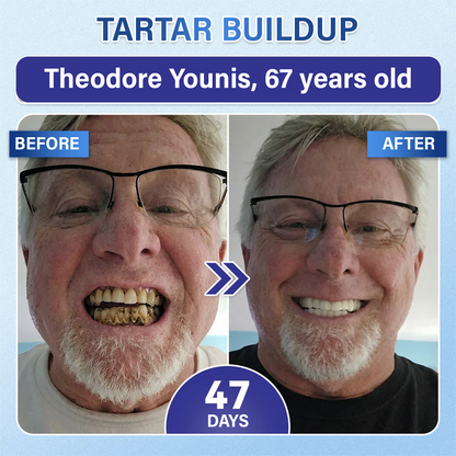 Alcuras®  Tooth & Gum Care Fast