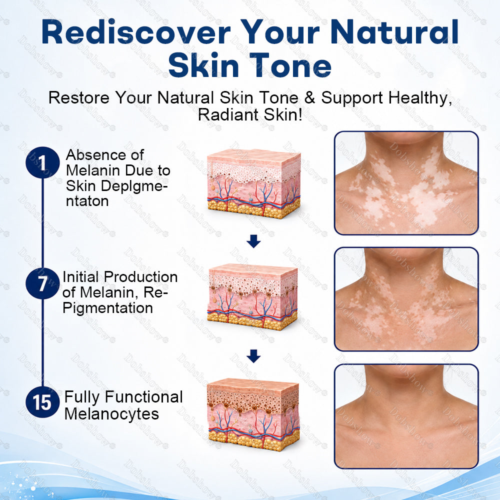 🔥100K+ SOLD | Alcuras® Advanced Piperine Vitiligo Repigmentation Spray — 👨‍⚕️✅Upgraded Steroid-Free Botanical Formula