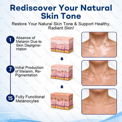 🔥100K+ SOLD | Alcuras® Advanced Piperine Vitiligo Repigmentation Spray — 👨‍⚕️✅Upgraded Steroid-Free Botanical Formula