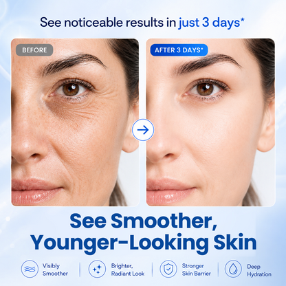 Alcuras® Avelyque Care Cream