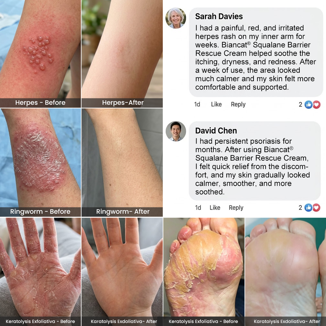 Alcuras® Squalane Barrier Rescue Cream