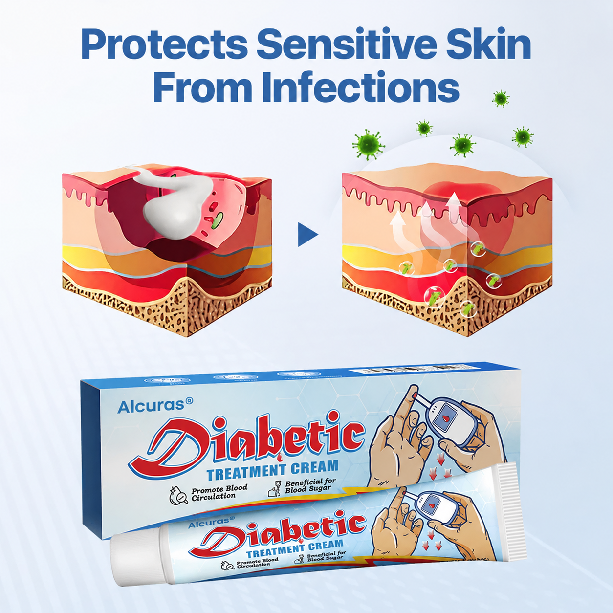 Alcuras® Diabetes Wound professional Treatment Cream