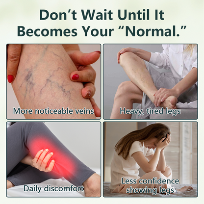 Alcuras® Advanced Vein Care Oil