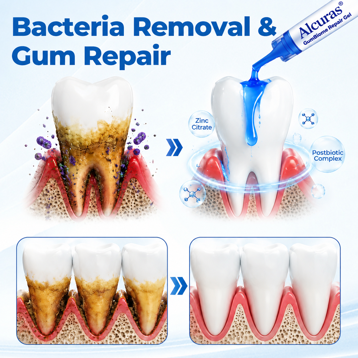 Alcuras® GumBiome Recovery Gel