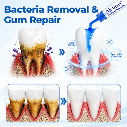Alcuras® GumBiome Recovery Gel