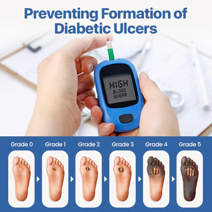 Alcuras® Diabetes Wound professional Treatment Cream