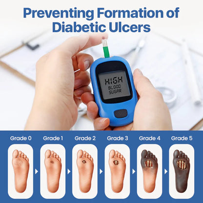 Alcuras® Diabetes Wound professional Treatment Cream