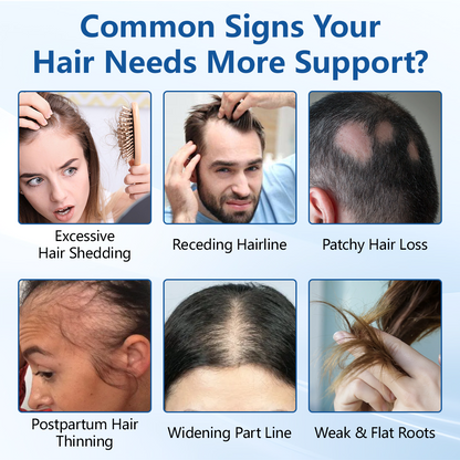 Alcuras® RootVive Hair Growth Serum Roll-On