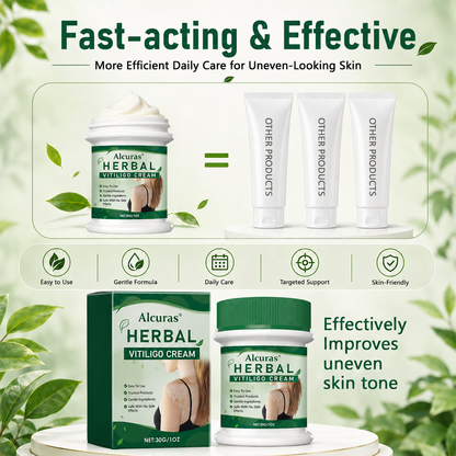 Alcuras® Herbal Vitiligo Cream