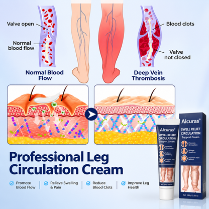 Alcuras® SwellRelief Circulation Support Cream🇺🇸