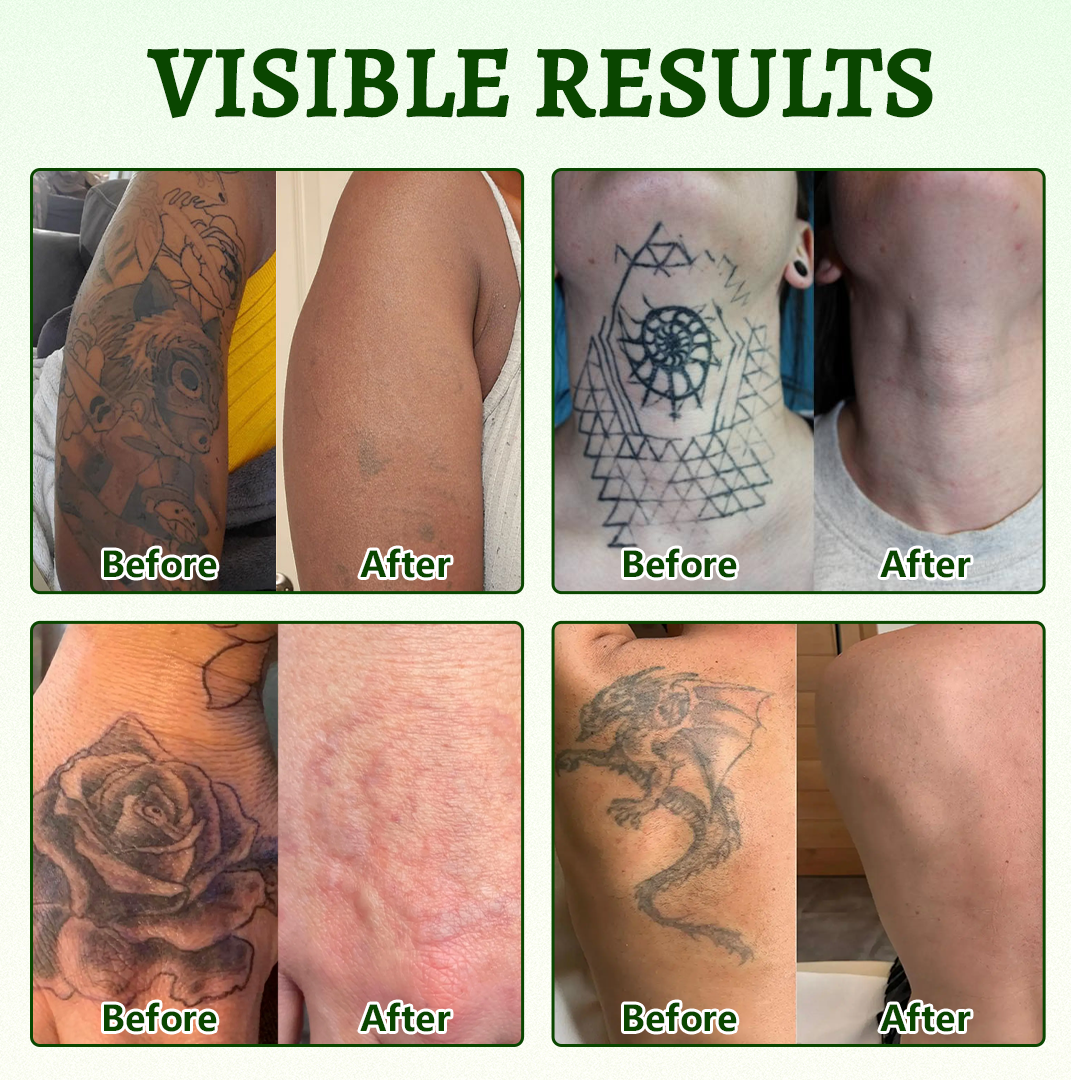 Alcuras® PureAlgae Ink Removal Support Spray 🌿