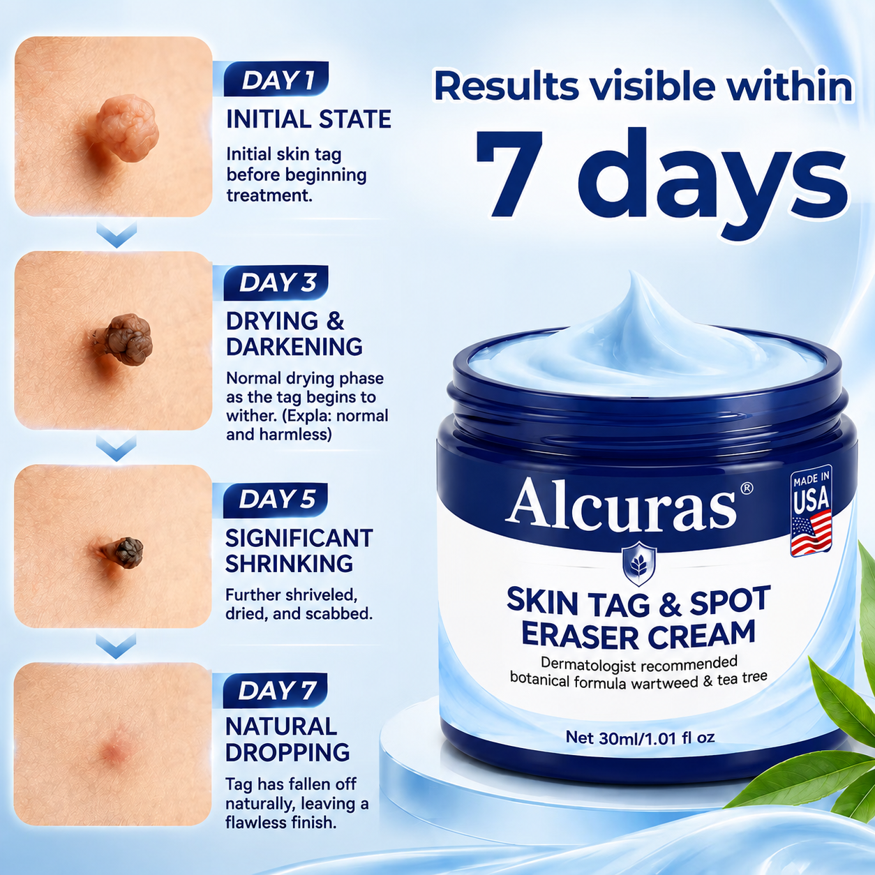 Alcuras® 7-Day Skin Tag & Spot Eraser Cream