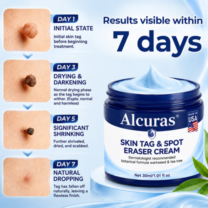 Alcuras® 7-Day Skin Tag & Spot Eraser Cream