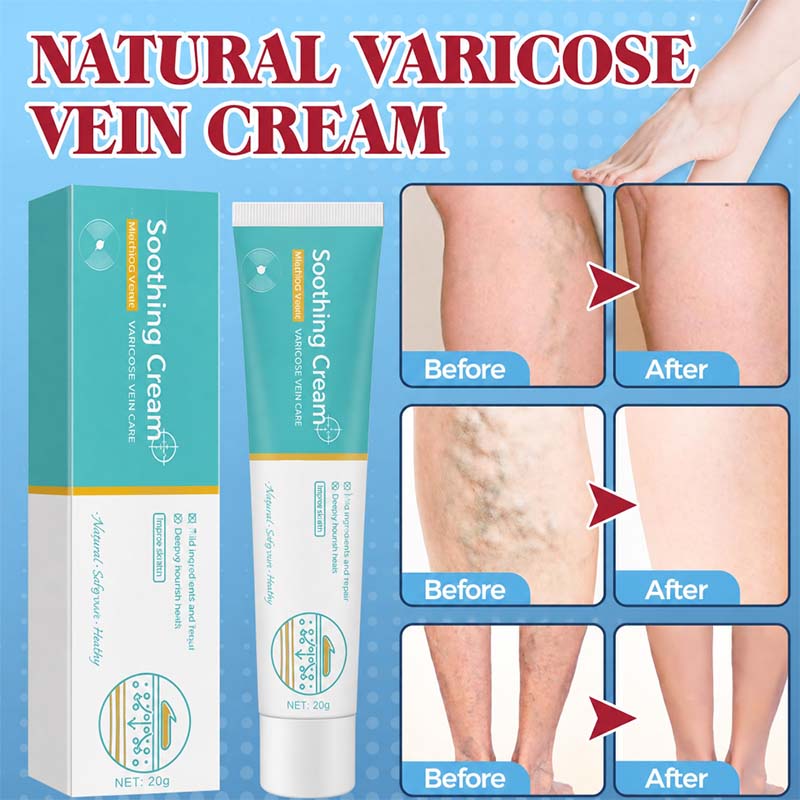 Herbal Varicose Veins Cream, Leg Relief Care🦵