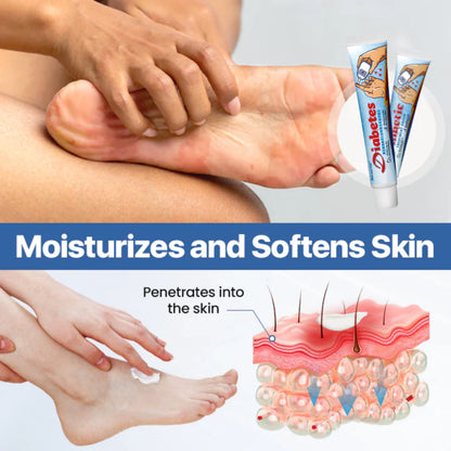 Alcuras® Diabetes Wound professional Treatment Cream
