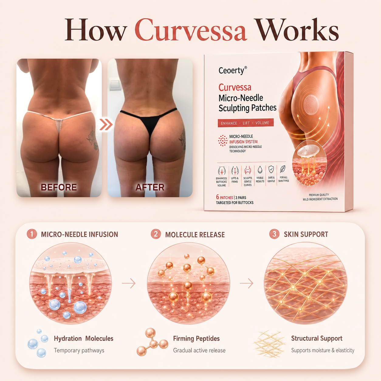 Alcuras® Curvessa Micro-Needle Sculpting Patches
