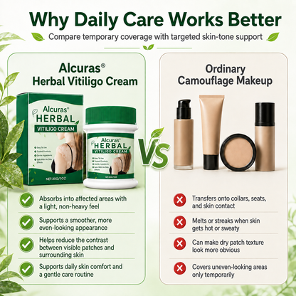 Alcuras® Herbal Vitiligo Cream