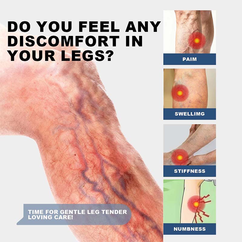 Herbal Varicose Veins Cream, Leg Relief Care🦵