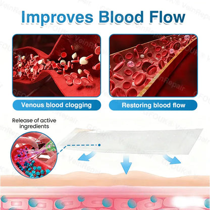 🇦🇺🏆✅️🏃Alcuras® VeinRepair Microneedle Patch Roll⚡Instant Relief, Long-Term Results