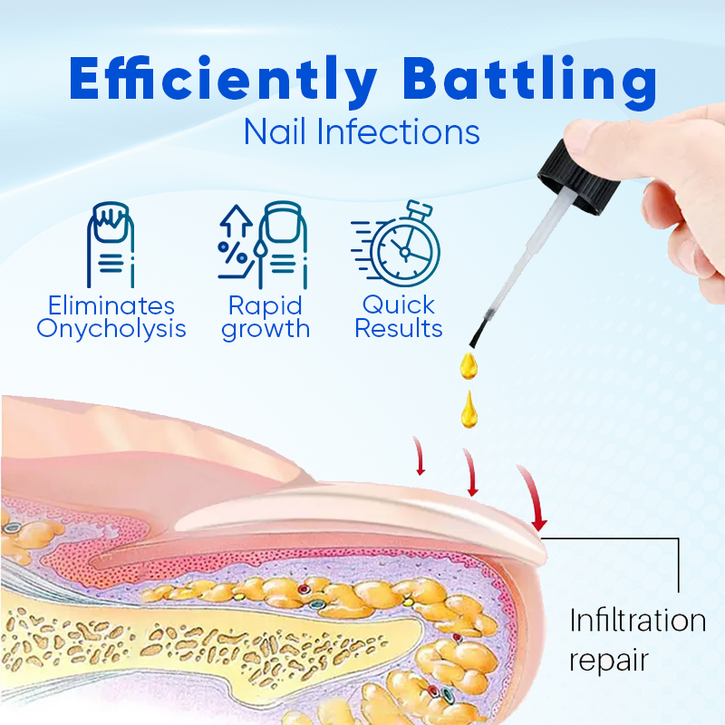 Alcuras® OnyxoGuard Nail Growth and Repair Serum