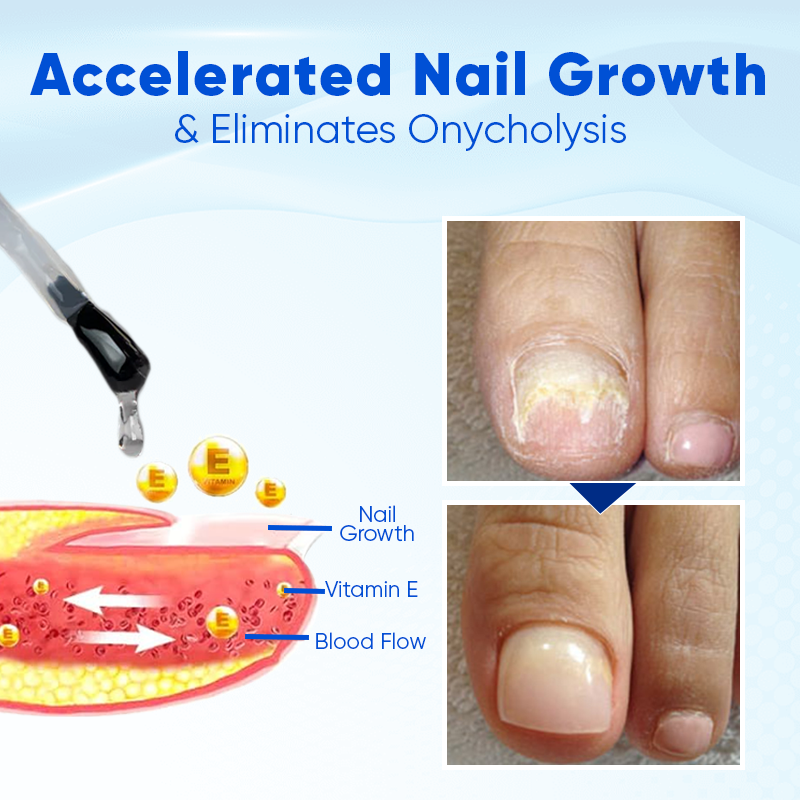 Alcuras® OnyxoGuard Nail Growth and Repair Serum
