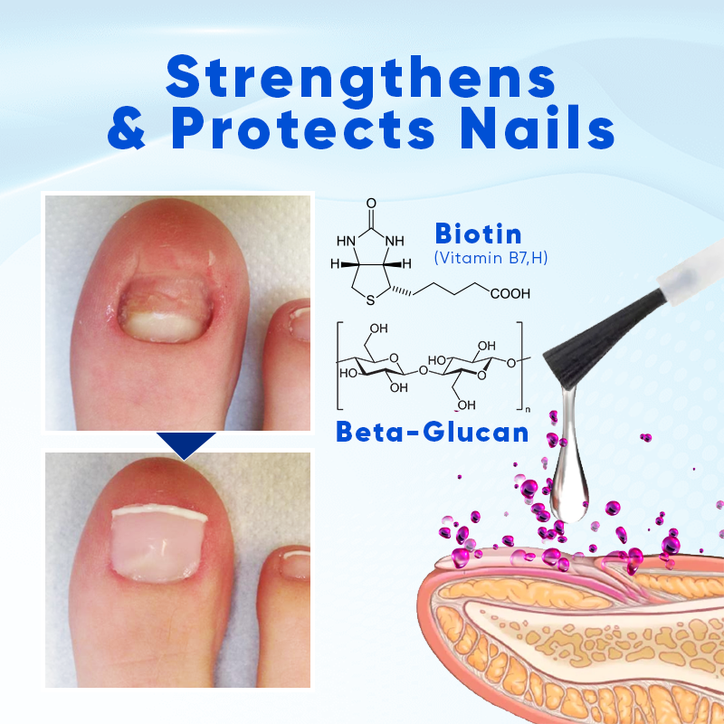 Alcuras® OnyxoGuard Nail Growth and Repair Serum