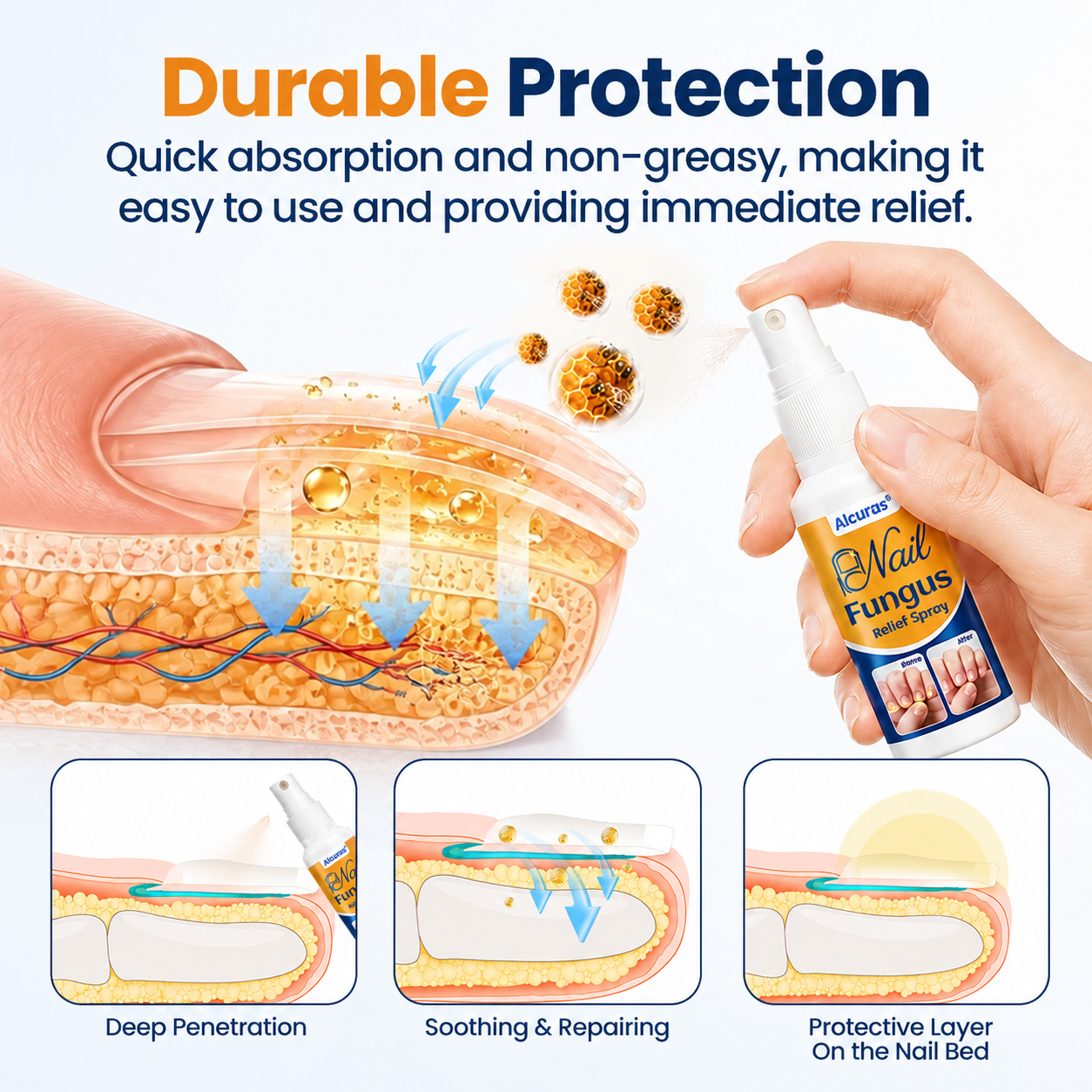 Alcuras® Nail fungus relief spray