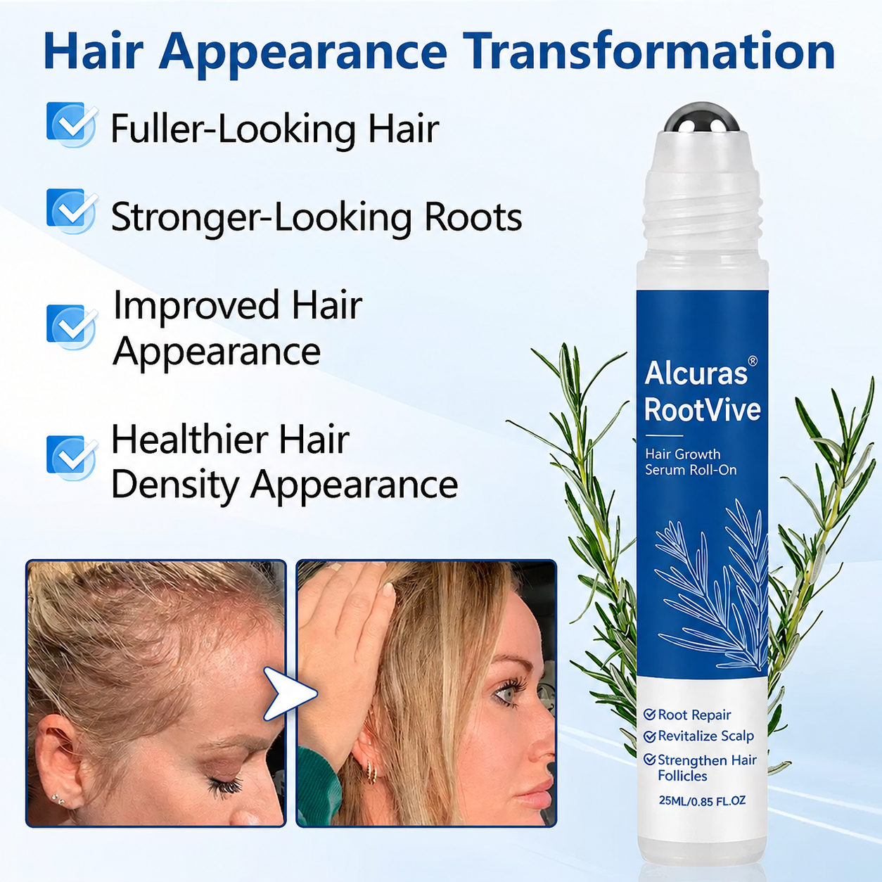 Alcuras® RootVive Hair Growth Serum Roll-On