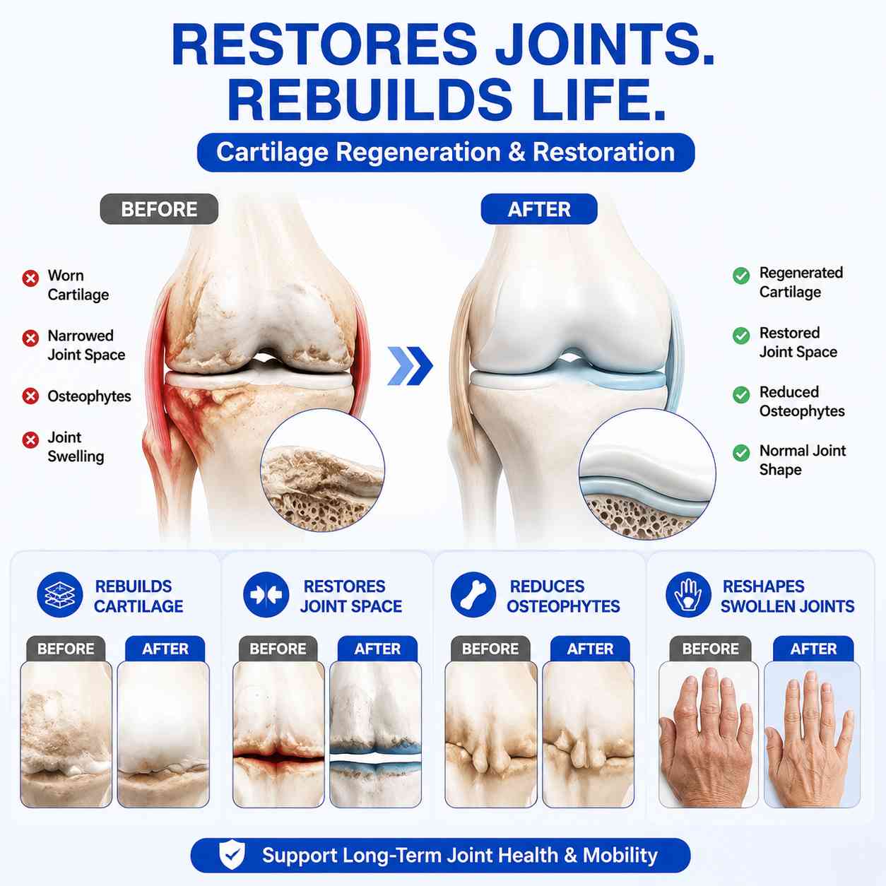 🍁Alcuras® PTH1R Arthritis Joint Cream