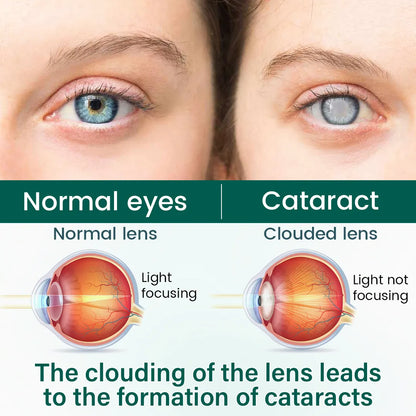 Alcuras®  OptiClear Nano Eye Roller Serum