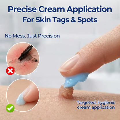 Alcuras® 7-Day Skin Tag & Spot Eraser Cream