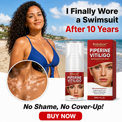 🔥100K+ SOLD | Alcuras® Advanced Piperine Vitiligo Repigmentation Spray — 👨‍⚕️✅Upgraded Steroid-Free Botanical Formula