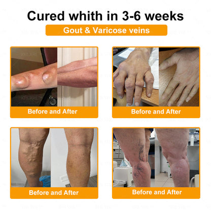 Alcuras® Bee Venom Pain-Relief Bone Healing Cream 🇺🇸(Specially for older adults)