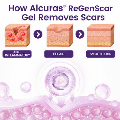 Alcuras® ReGenScar Stem Cell Scar Gel