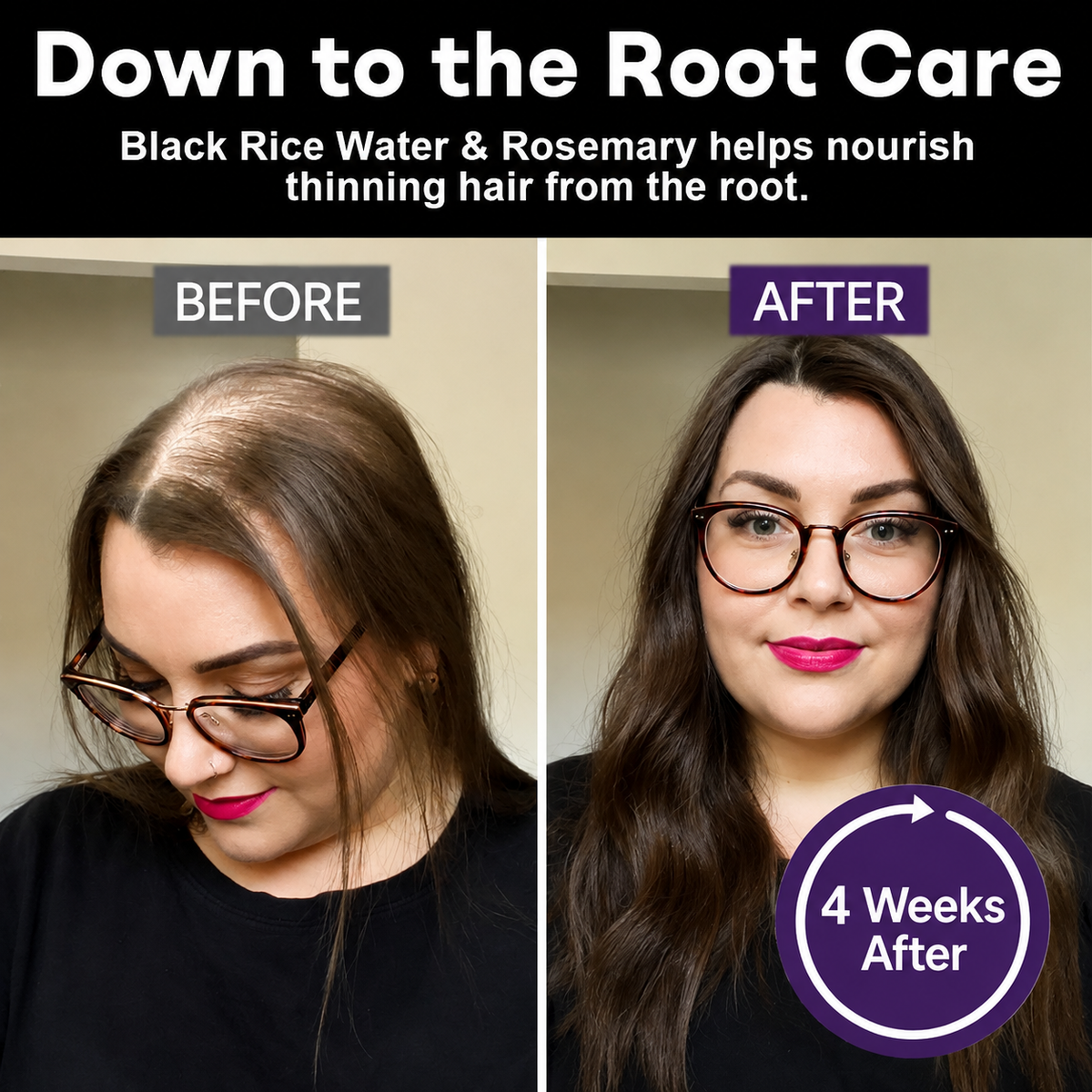 🔥Alcuras® Black Rice & Red Onion Hair Growth Spray