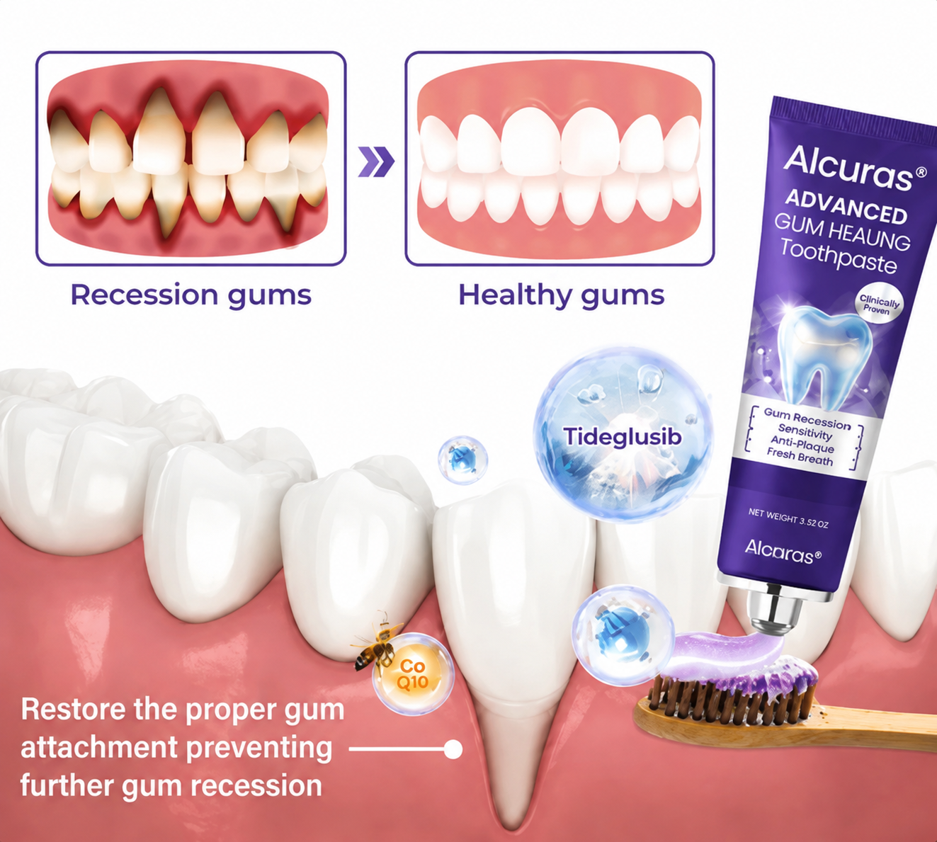 Alcuras® Advanced Gum Healing Toothpaste